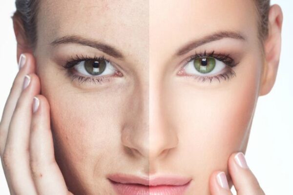 Natural Beauty x Tech = Better Skin Health