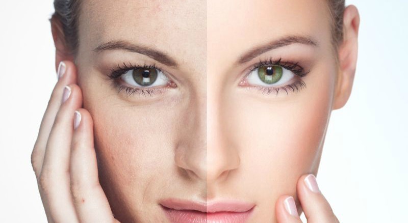 Natural Beauty x Tech = Better Skin Health