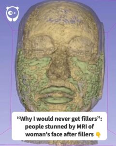 Red circle with three diagonal black lines on bottom left.