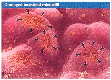 Close-up of damaged intestinal microvilli with arrows indicating affected areas.