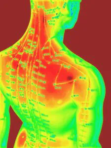 Thermographic image showing heat points on a person's upper back and neck. Thermographic image showing heat points on a person's upper back and neck.